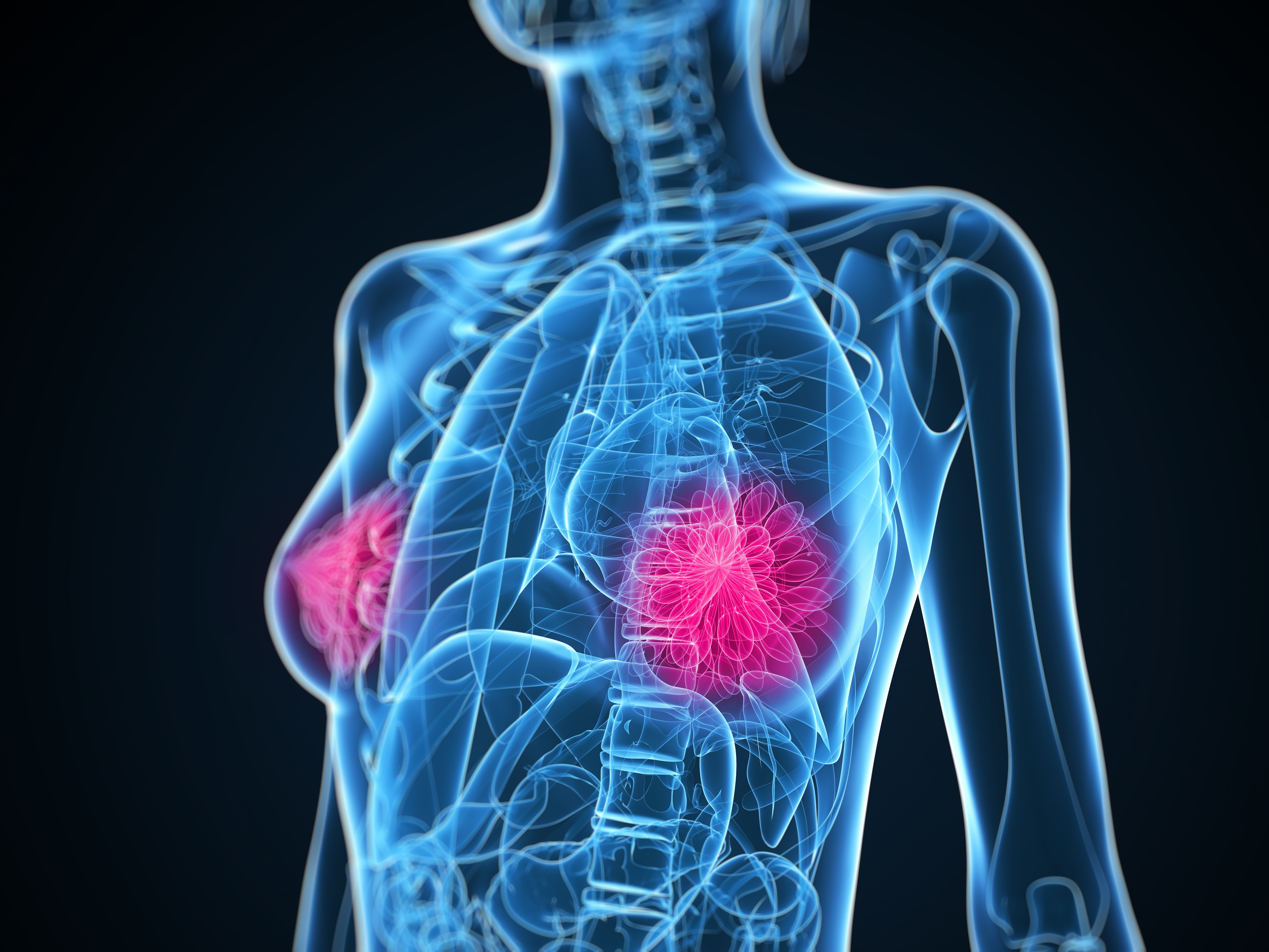 Breast