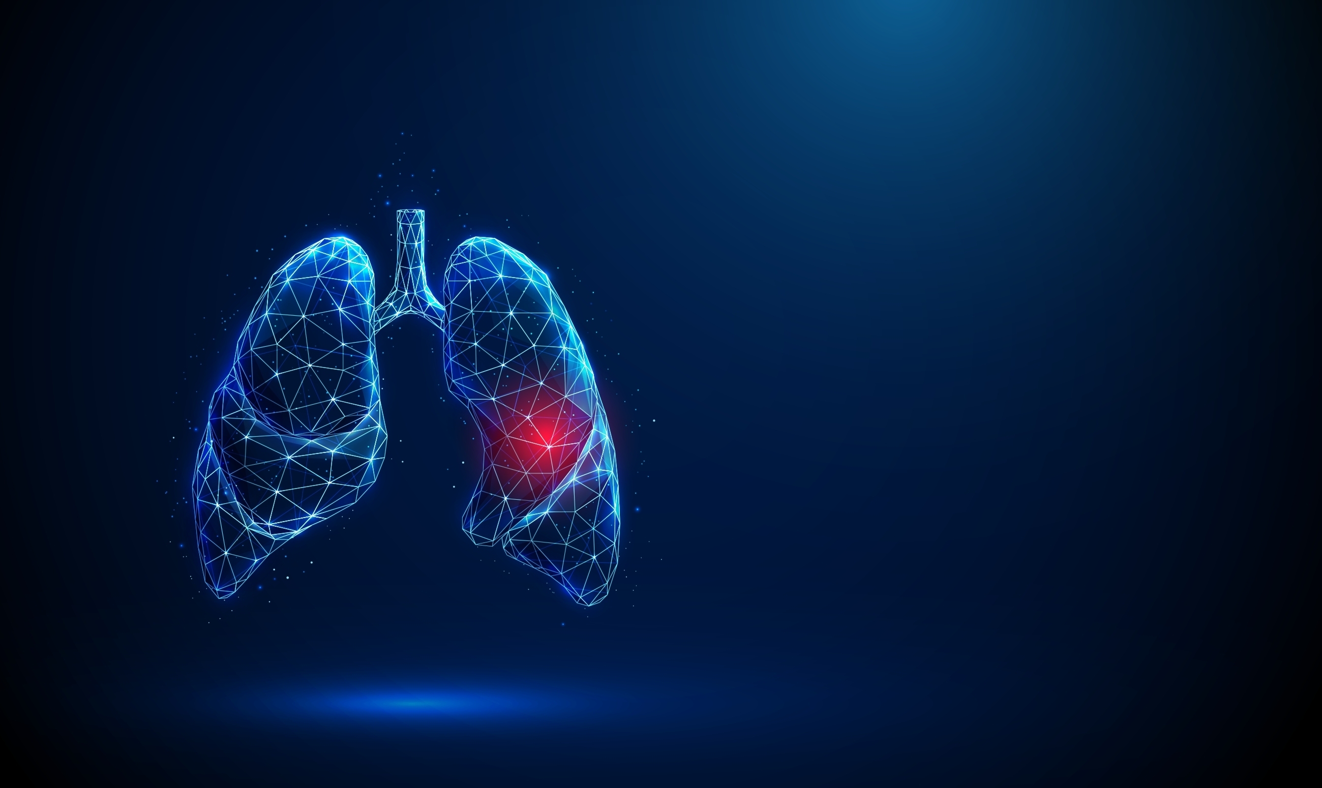 lungcancerbild